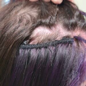 Hair extensions attached to scalp